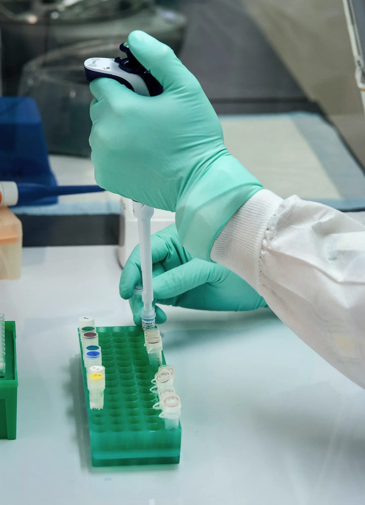 Hände in Laborhandschuhen pipettieren Proben